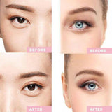 Dream Eyes™ - Instant Eye Lift